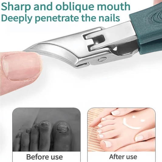 🔥Dernier jour de vente 49 % de réduction - Eagle Beak Angled Nail Clippers Set de 3 pièces