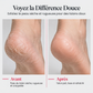 🔥 50% DE RÉDUCTION ! ✨Râpe électrique étanche pour les callosités des pieds avec soin par lumière rouge et bleue